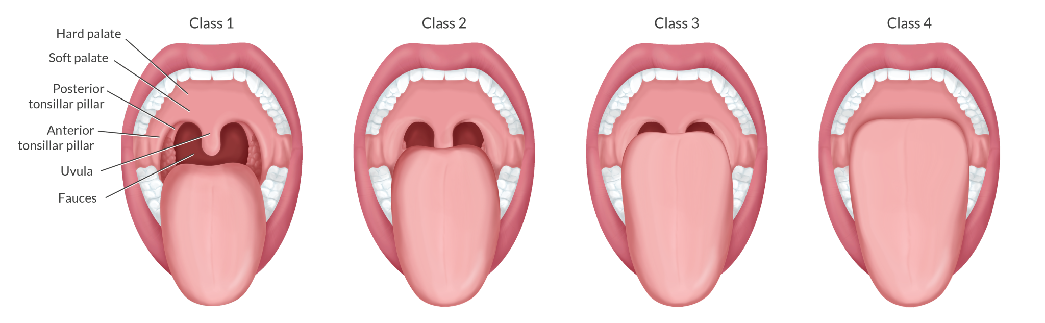 Learn the Importance of Medical Eponyms | APEX Anesthesia