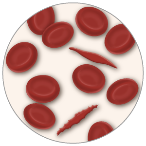 red blood cells vs sickle cells