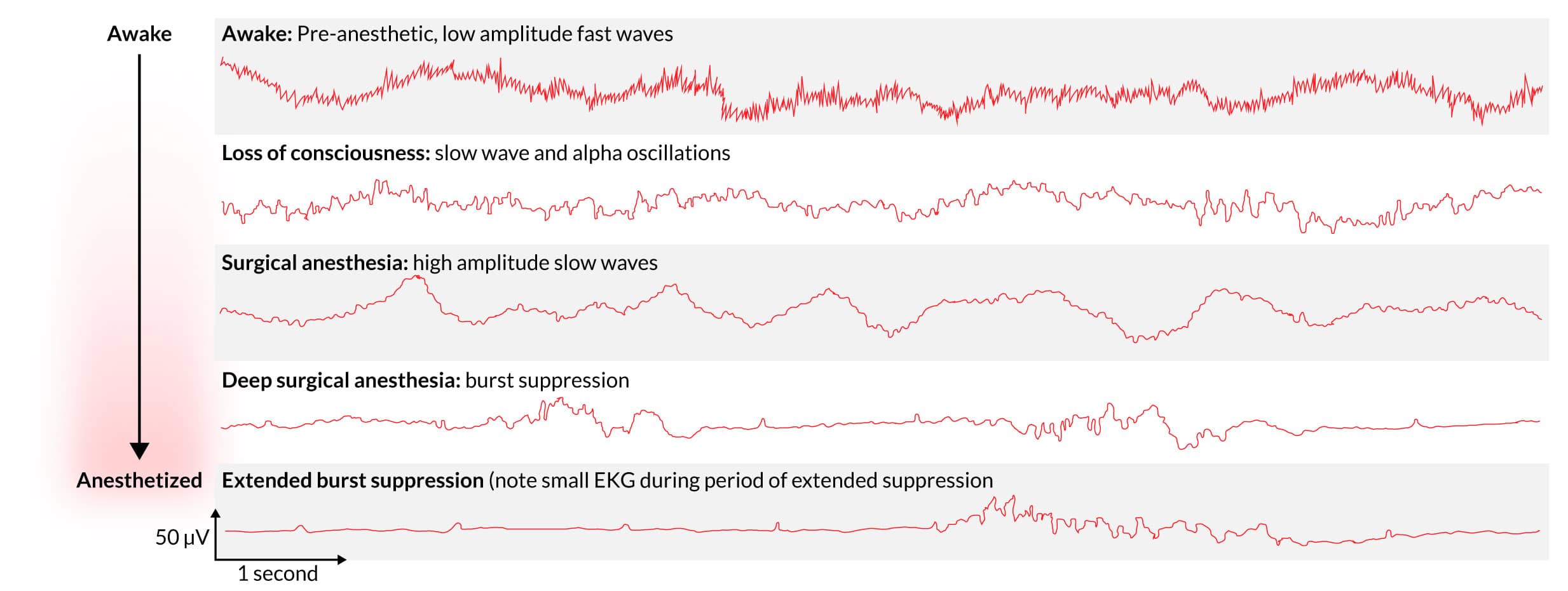 EEG monitoring examples