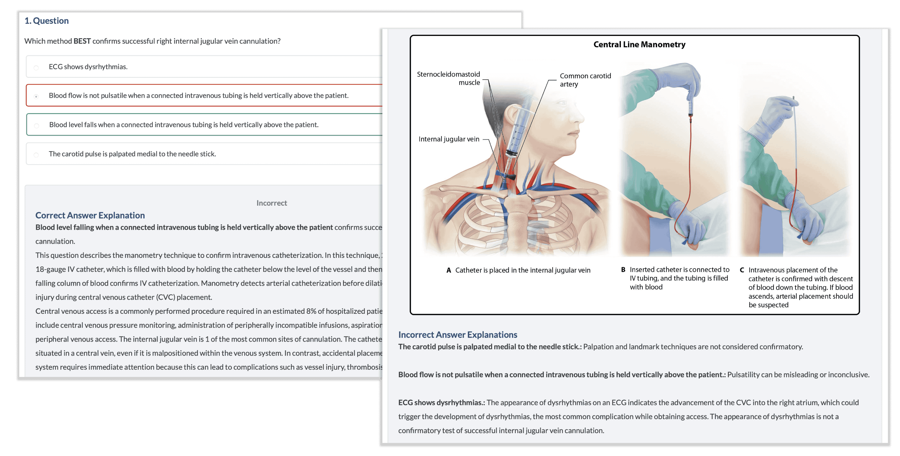 detailed explanation of a quiz question