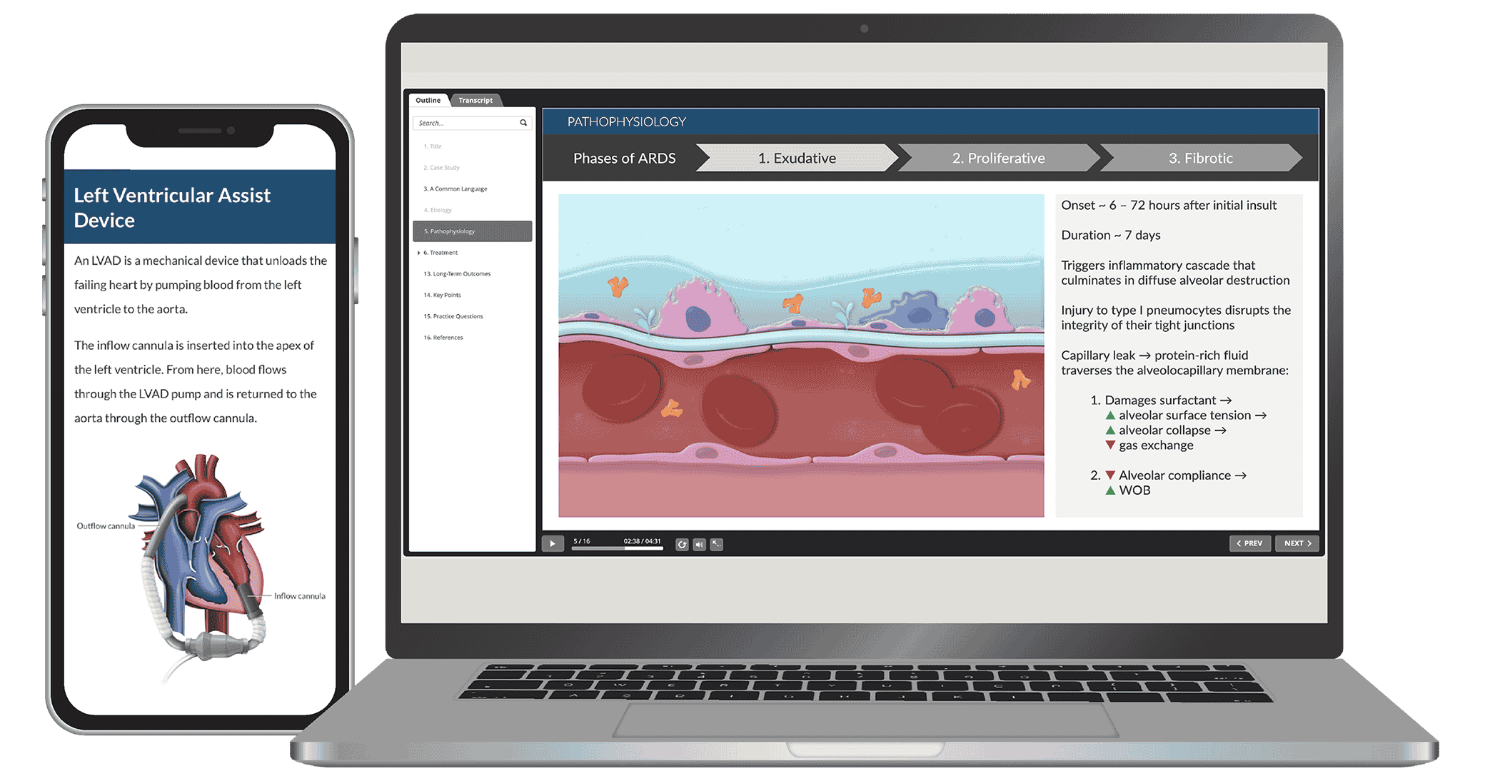 A phone and a laptop with diagrams for the Left Ventricular Assist Device and Pathophysiology course materials.